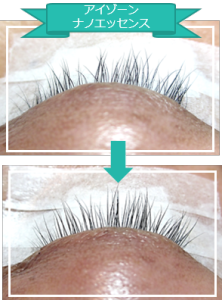 アイゾーン画像2 (2)